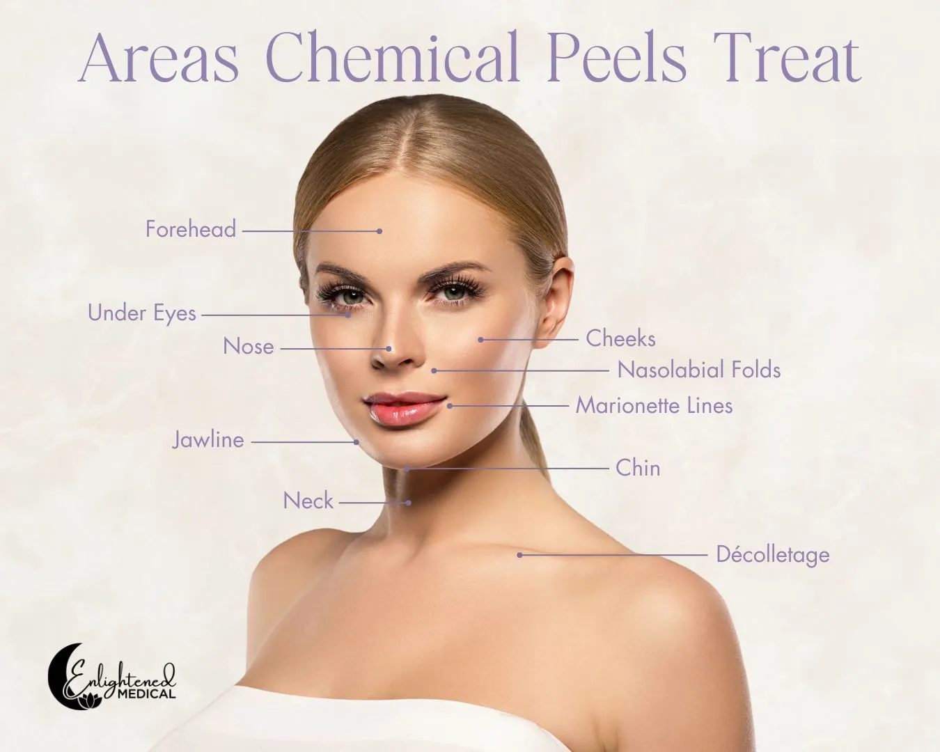 Graphic of woman with areas listed that chemical peels treat