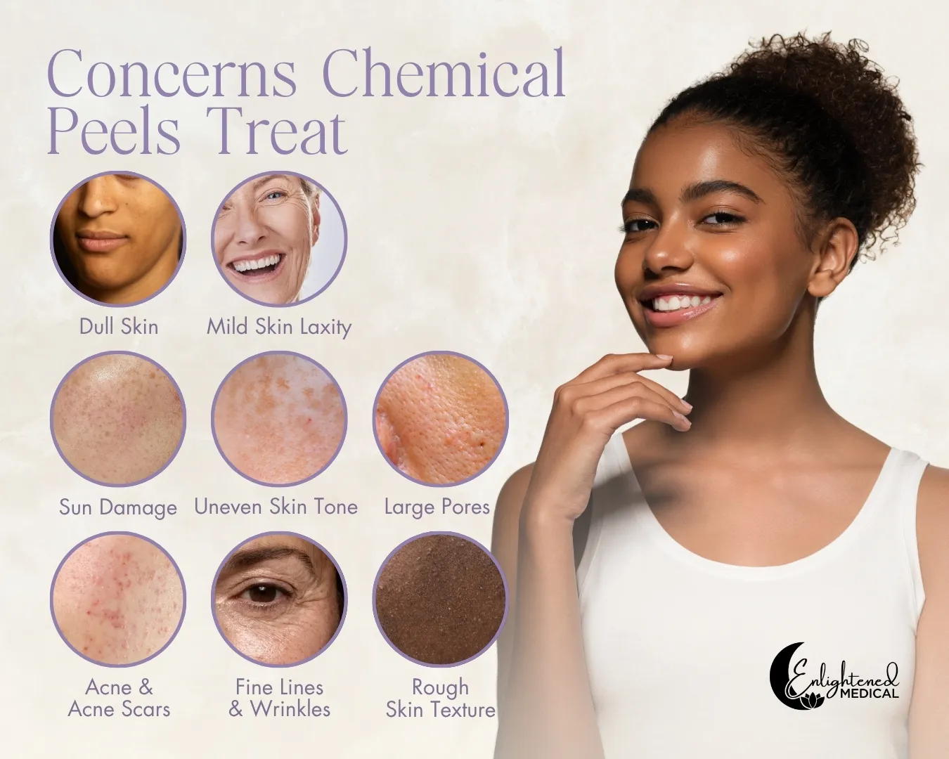 Graphic listing concerns that chemical peels treat