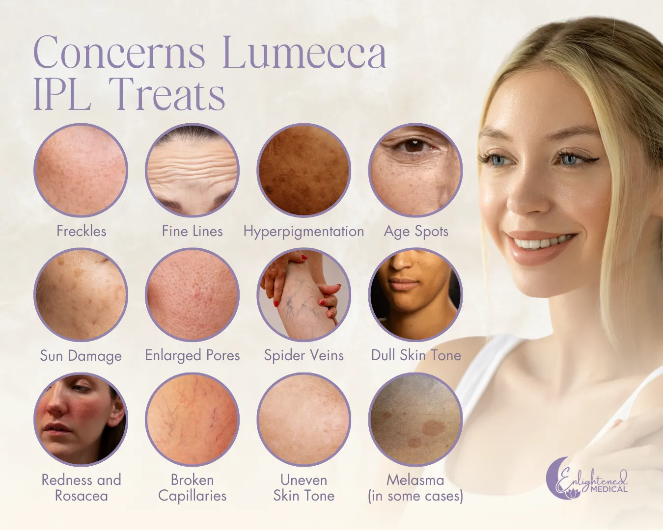 Concerns Lumecca IPL Treats. A smiling woman is shown next to visual examples of skin concerns like freckles, fine lines, hyperpigmentation, sun damage, spider veins, rosacea, and melasma